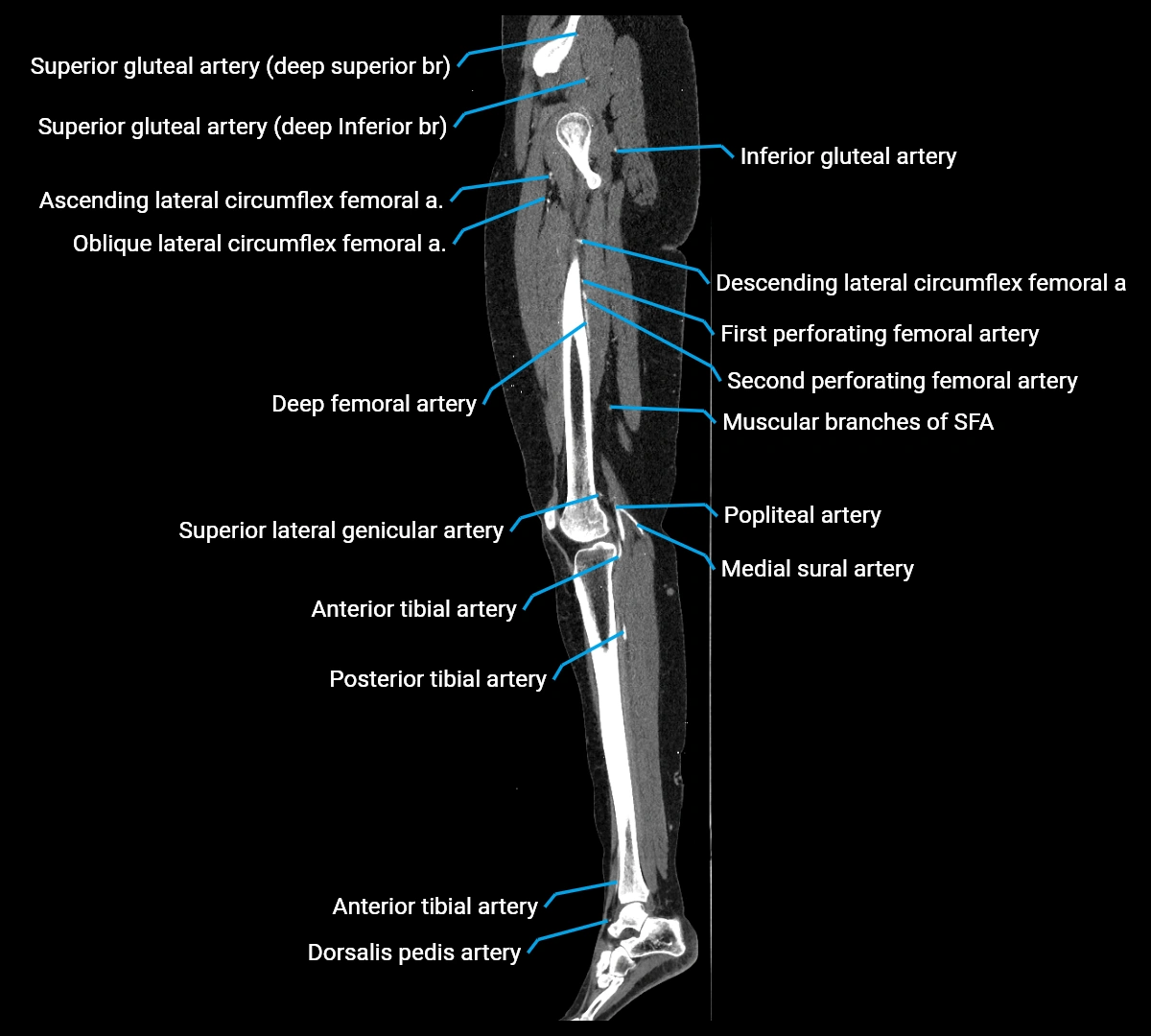 CTA lower limb sagittal cross sectional anatomy labelled image _46 (3).webp